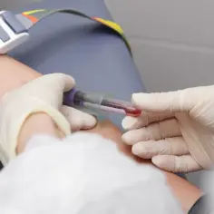 Co to jest rdw cv w badaniu krwi i dlaczego jest ważne dla zdrowia?